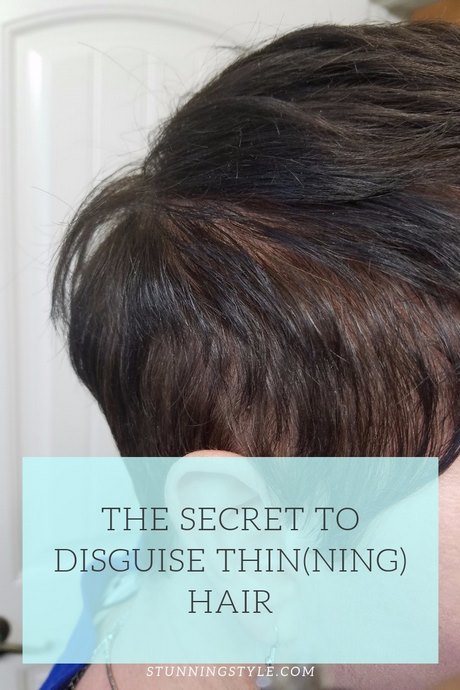 hairstyles-for-thinning-hair-in-front-woman-24_15 Hairstyles for thinning hair in front woman